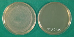 Propionibacterium acnes (アクネ菌)