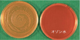 Sigella flexneri (赤痢菌)