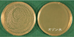 Streptococcus mutanns (ミュータンス菌)